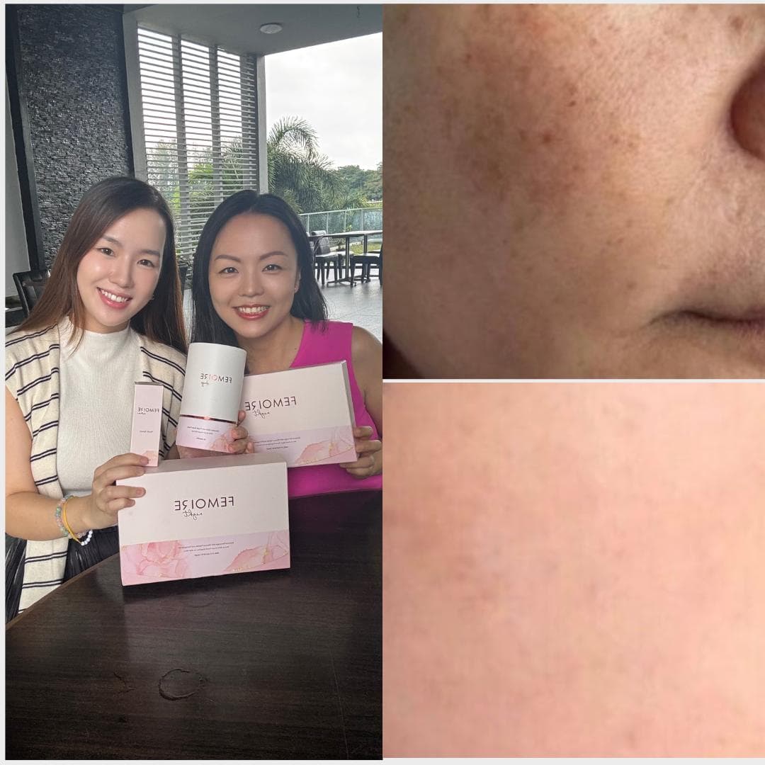 Rainie — before and after using Femoire