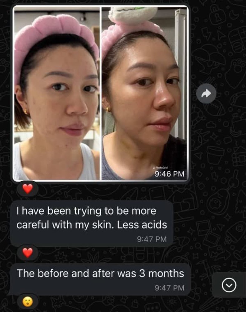 Customer WhatsApp before-and-after over 3 months, being more careful with skin