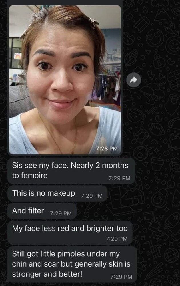 Customer WhatsApp: nearly 2 months on Femoire, no makeup or filter, skin less red and brighter
