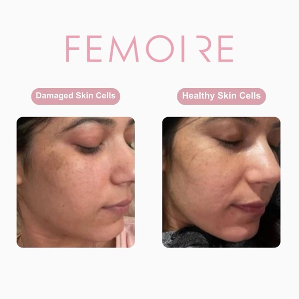 Customer WhatsApp before-and-after on Femoire